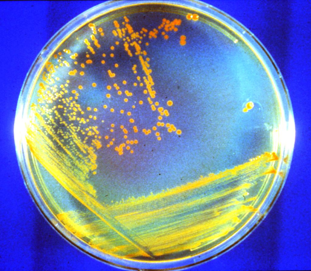 a microscope slide shows a sample of Conan the Bacterium